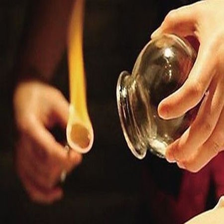 九龙坡专业玻璃拔罐